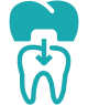 Crowns